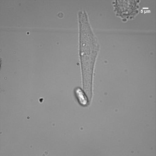 A brightfield image of a healthy triangular cell in the center and a dead or blebbed cell in the corner